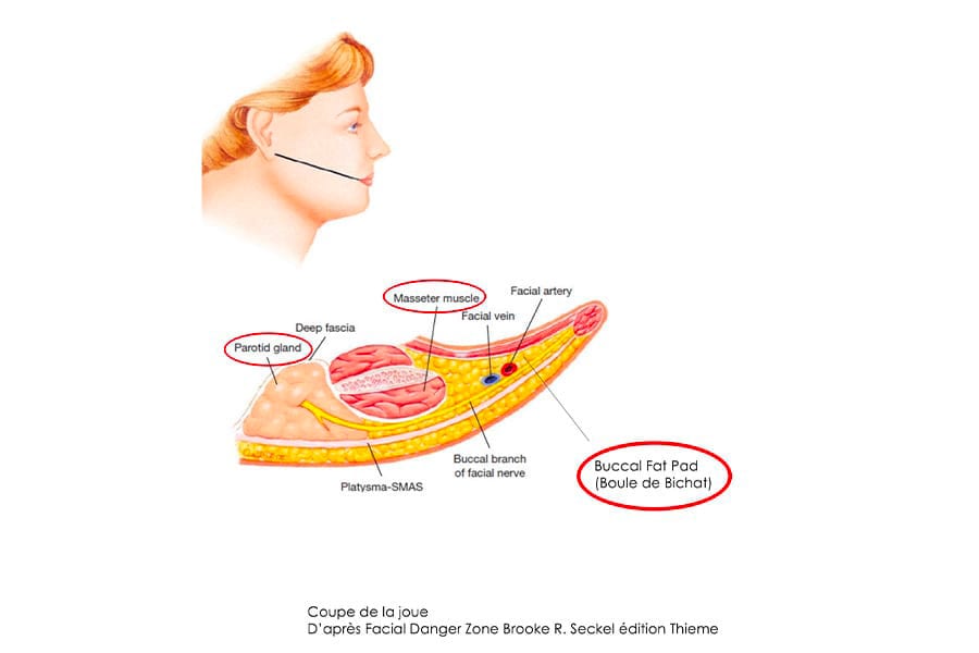 liposuccion HD chirurgie silhouette chirurgie esthetique paris dr philippe pelissier chirurgien plasticien esthetique paris