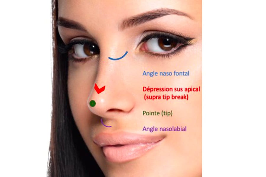 liposuccion HD chirurgie silhouette chirurgie esthetique paris dr philippe pelissier chirurgien plasticien esthetique paris