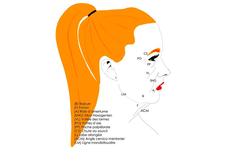 liposuccion HD chirurgie silhouette chirurgie esthetique paris dr philippe pelissier chirurgien plasticien esthetique paris